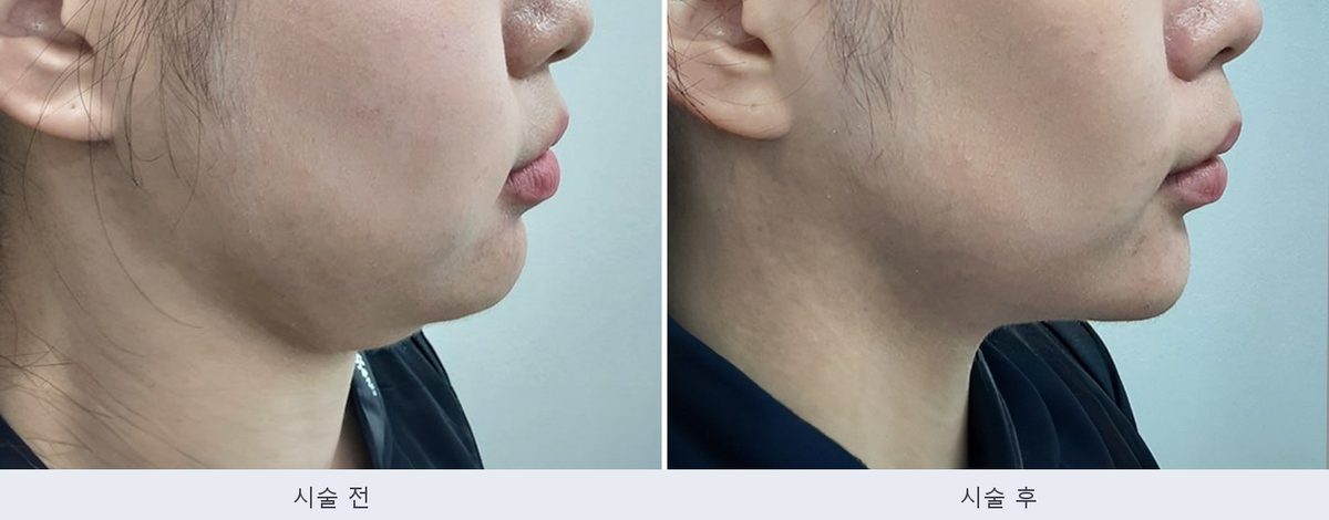 인모드